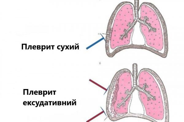 b1f140d030edb73901707d0d1ad93e5a_800xauto-q-85